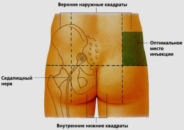 Как правильно сделать выбор места для укола