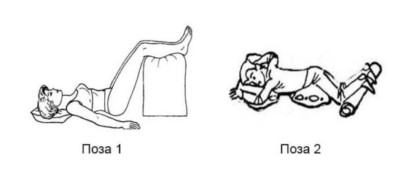 Рекомендуется принимать в постели такие позы, которые сами способствуют снятию воспаления и боли при поясничном радикулите