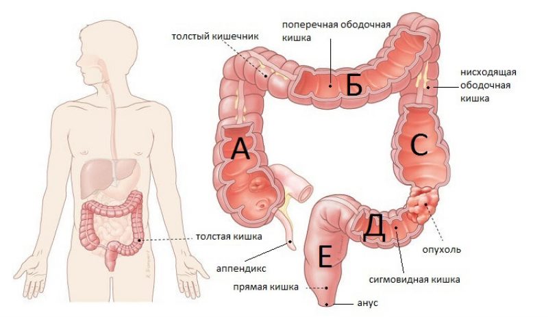 Где находится кишечник у человека фото и как болит симптомы у женщин