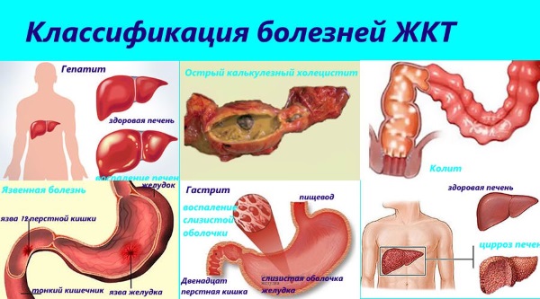 При болезнях ЖКТ такая проблема тоже может возникнуть