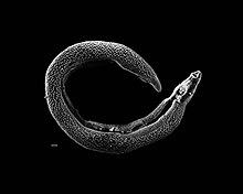 Schistosoma 20041-300.jpg