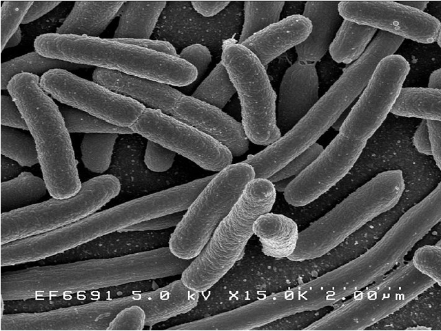 бактероиды электронный микроскоп