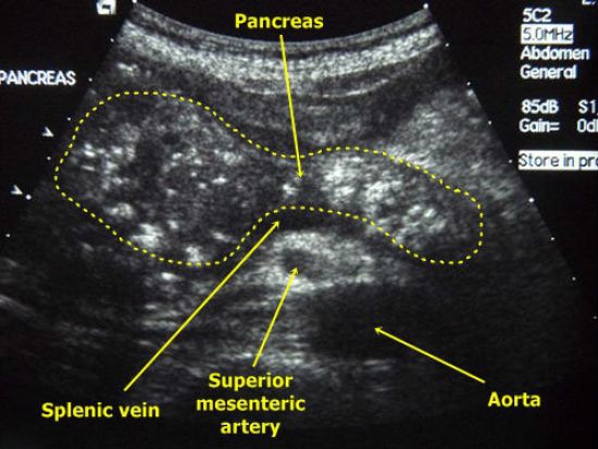 УЗИ поджелудочной железы