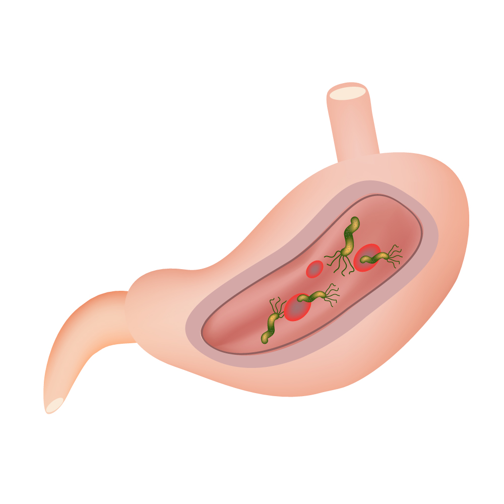 Бактерия Helicobacter pillory.jpg