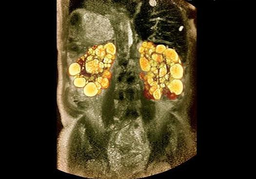 МРТ органов брюшной полости